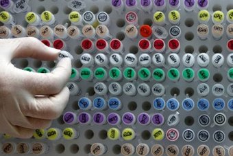 Britanci će modificirati gene ljudskog embrija