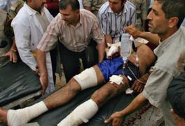 Irak: U napadu bombaša samoubice poginulo najmanje 50 osoba