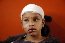 Ritiksha Navnitbhai, jedna od povrijeđenih djevojčica