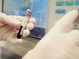 Test krvi za rano otkrivanje raka pluća