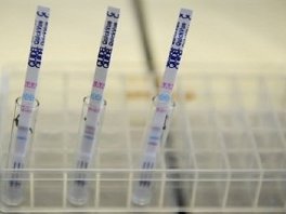 Ima li svinjske gripe u BiH znat će se u naredna dva dana