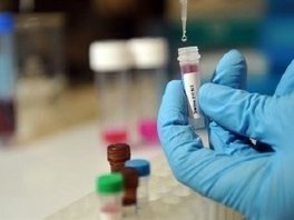 Pandemija gripe H1N1 nezaustavljiva