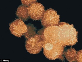 Ćelije raka prostate (Foto: Alamy)