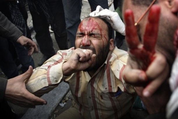 Foto: AP