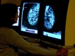 Širom Evrope opada smrtnost od karcinoma
