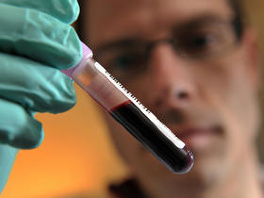 Svi doping-testovi na SP-u u plivanju negativni