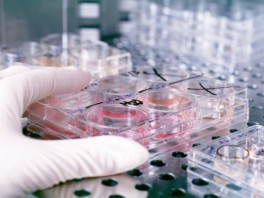 Naučnici istražuju novi test krvi koji otkriva rak dojke u ranoj fazi