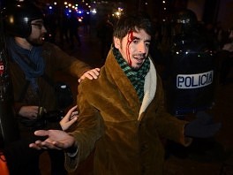 Jedan od povrijeđenih demonstranata u Madridu (Foto: AFP)