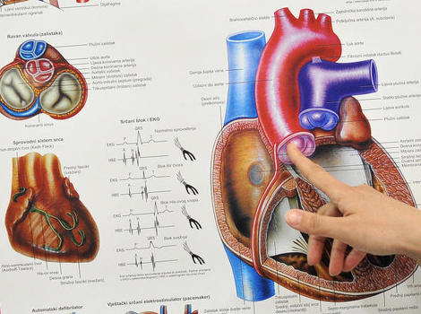 Arterijska hipertenzija: Kako kontrolirati visoki tlak?
