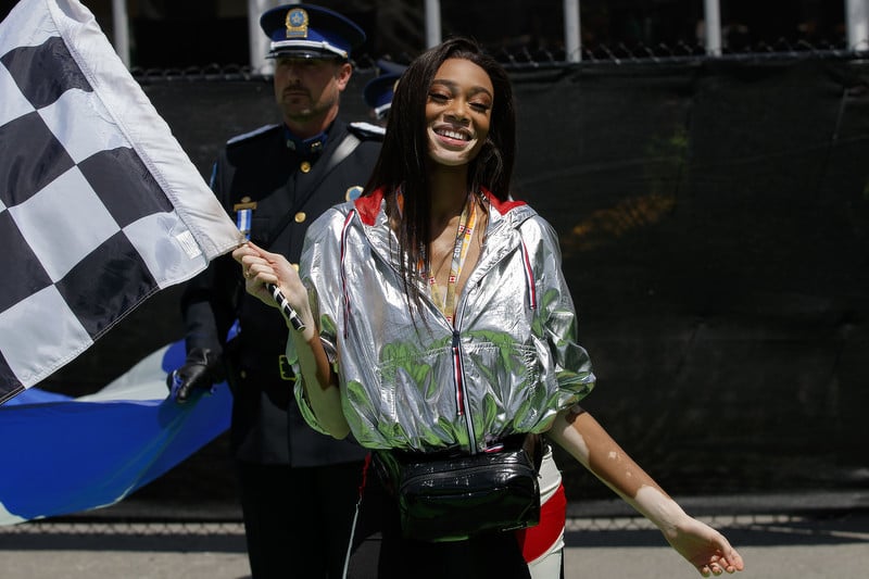 Winnie Harlow (Foto: EPA-EFE)