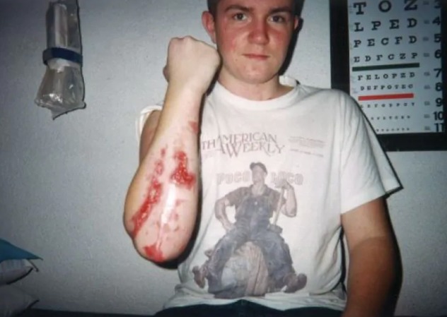 Ramić tokom oporavka