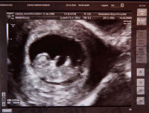 Fotografija: The Sun