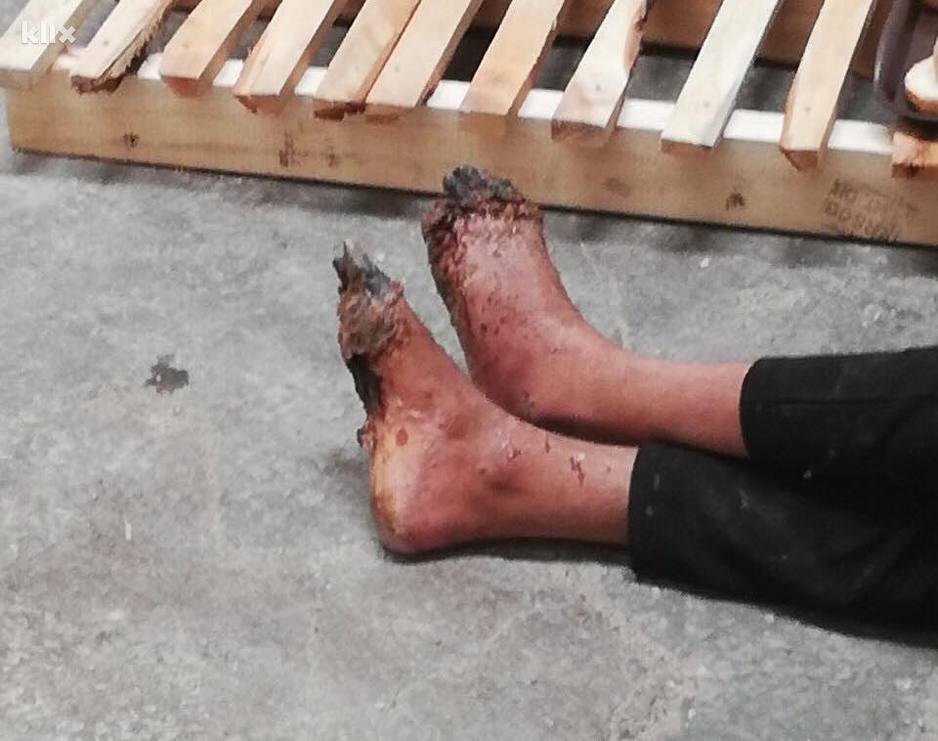 Tunižanin koji doslovno čeka smrt od gangrene (Foto: Dirk Planert)