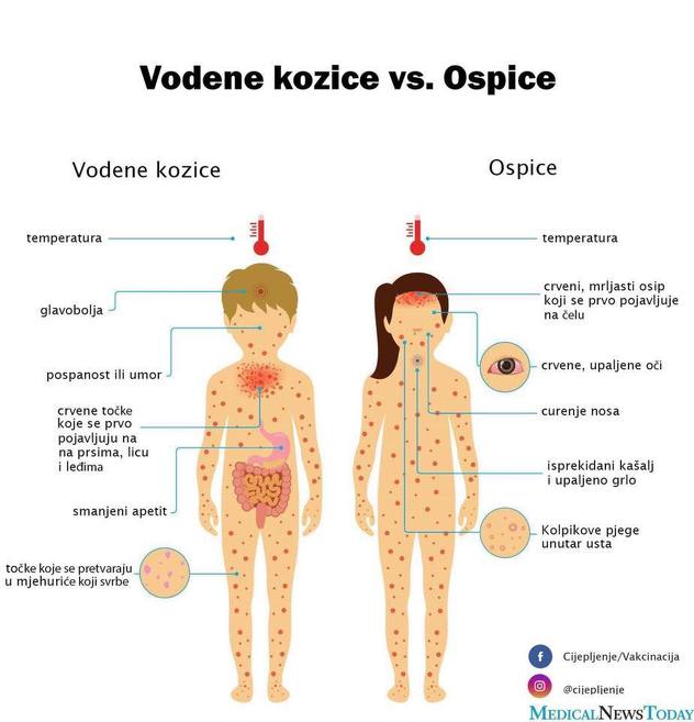 Foto: Facebook (Cijepljenje i vakcinacija)