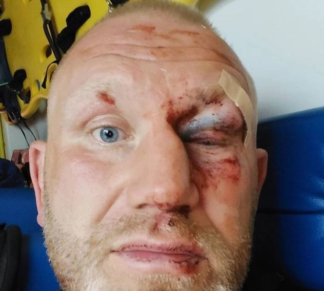 Haritonov je pokazao kako izgleda nakon tuče (Foto: Instagram)