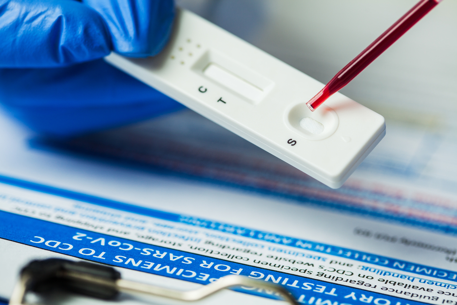 Serološki testovi otkrivaju stvorena antitijela na antigen iz klase IgM i IgG (Ilustracija: Shutterstock)