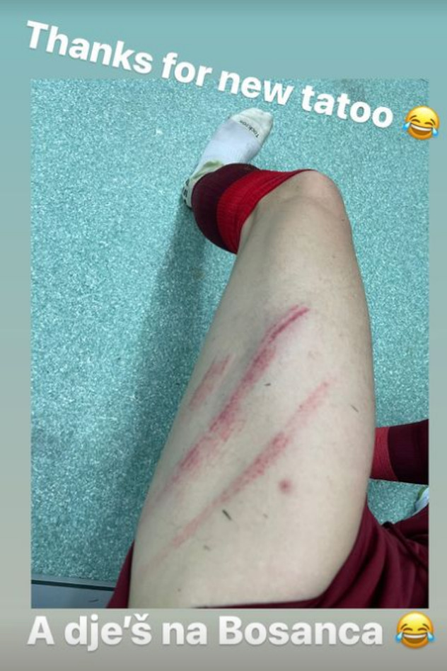 Memiševićev Instagram story