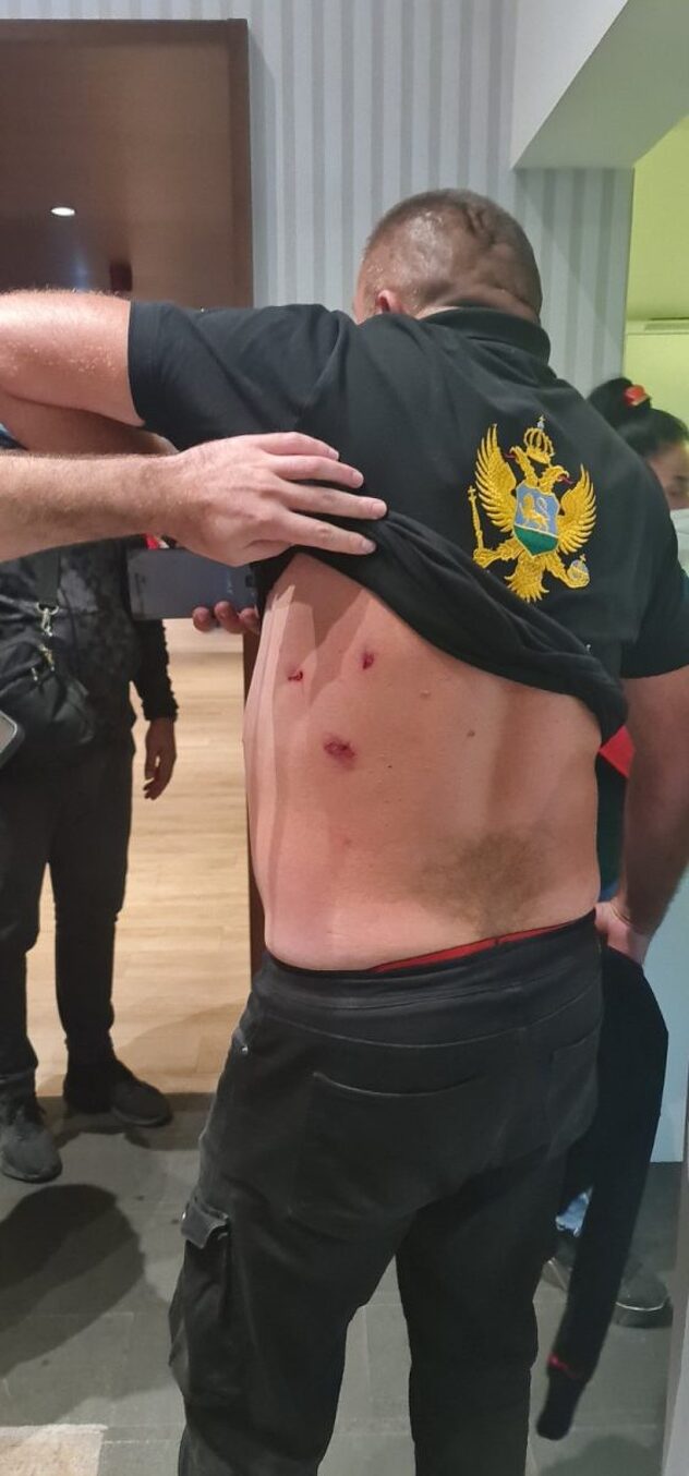 Učesnik protesta povrijeđen u leđa (Foto: Standard)