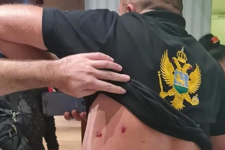 Jedan od povrijeđenih