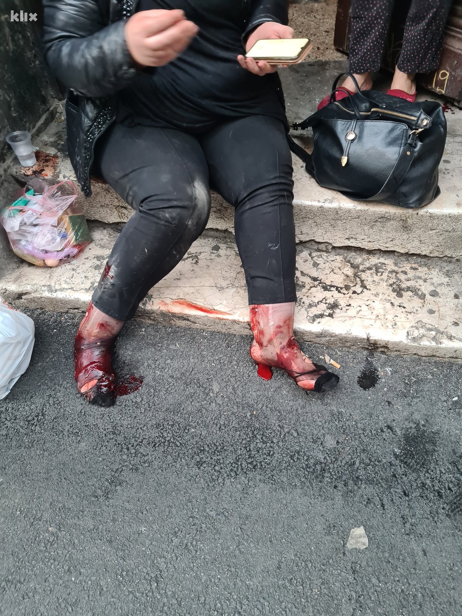 Ugrizi i krv po nogama (Foto: Klix.ba)