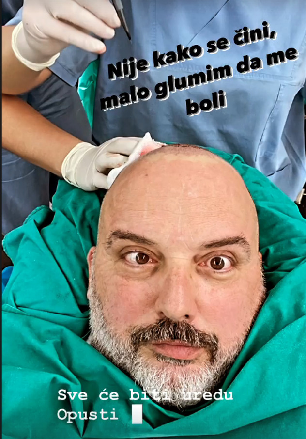 Cetinski tokom transplatacije kose (Foto: Screenshot)