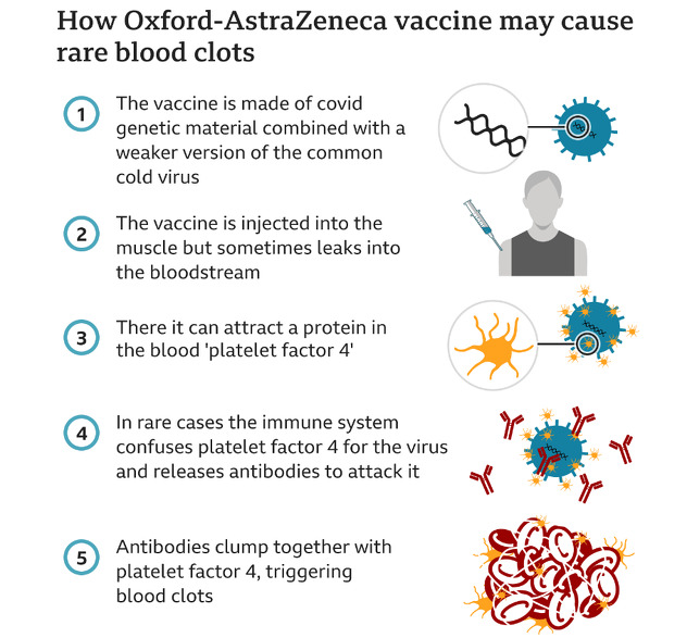 Postojala su dva početna traga za istraživače koji su istraživali rijetke krvne ugruške (Foto: Screenshot)