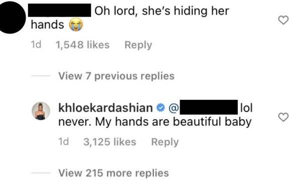 Khloe Kardashian odgovorila na pogrdne komentare o svojim rukama