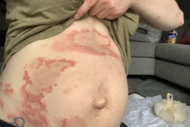 Foto: Kennedy News and Media