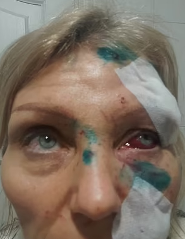 Pokazala je da njene rane nisu lažne (Foto: Daily Mail)