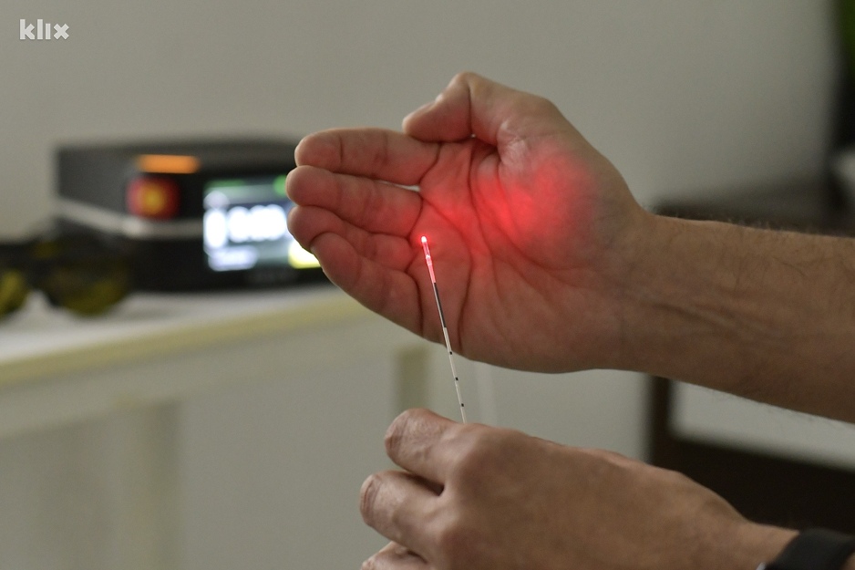 Aparat kojim se izvodi laserski tretman proširenih vena (Foto: I. Š./Klix.ba)