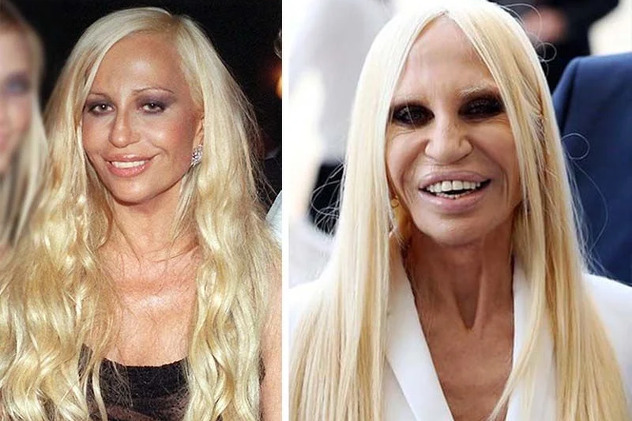 Donatella nekad i sad (Foto: Twitter)