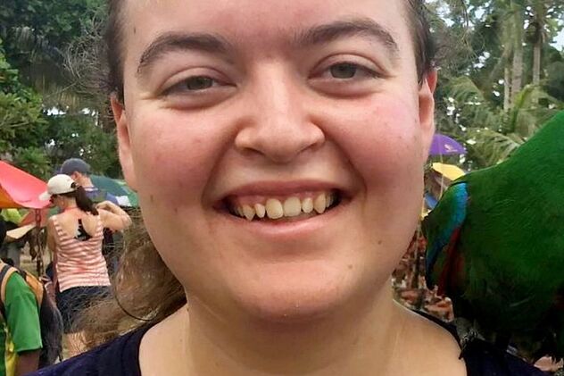 Ovako je izgledala dok je uklanjala dlačice