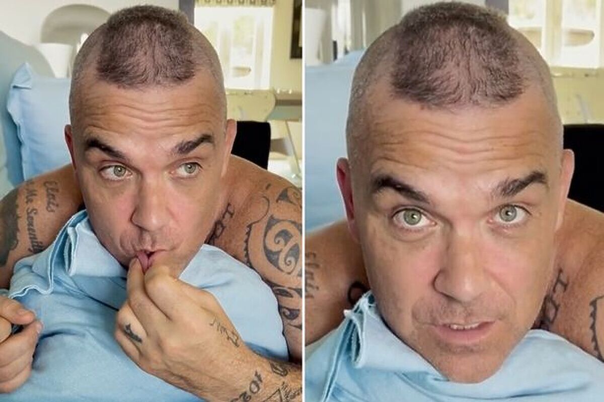 Robbie Williams ima problem s kojim se suočava većina muškaraca srednje dobi (Foto: Instagram)