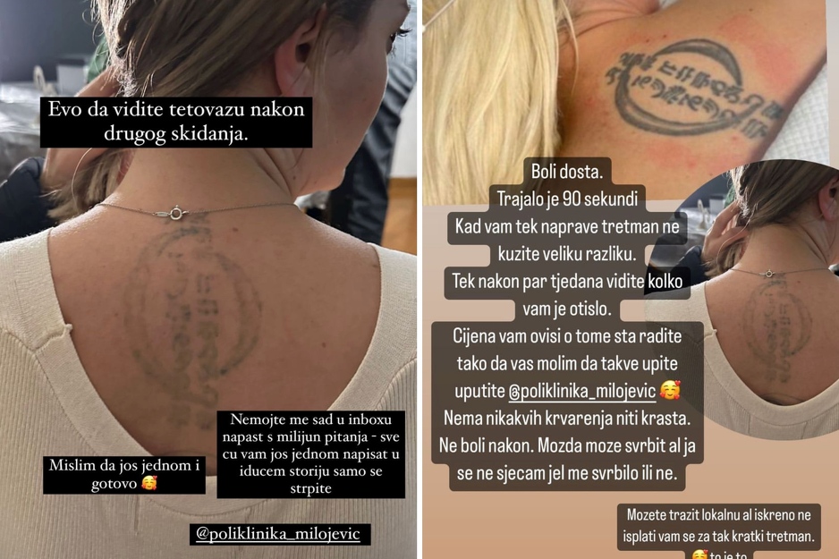 Snimak Elline tetovaže nakon tretmana (Foto: Instagram)