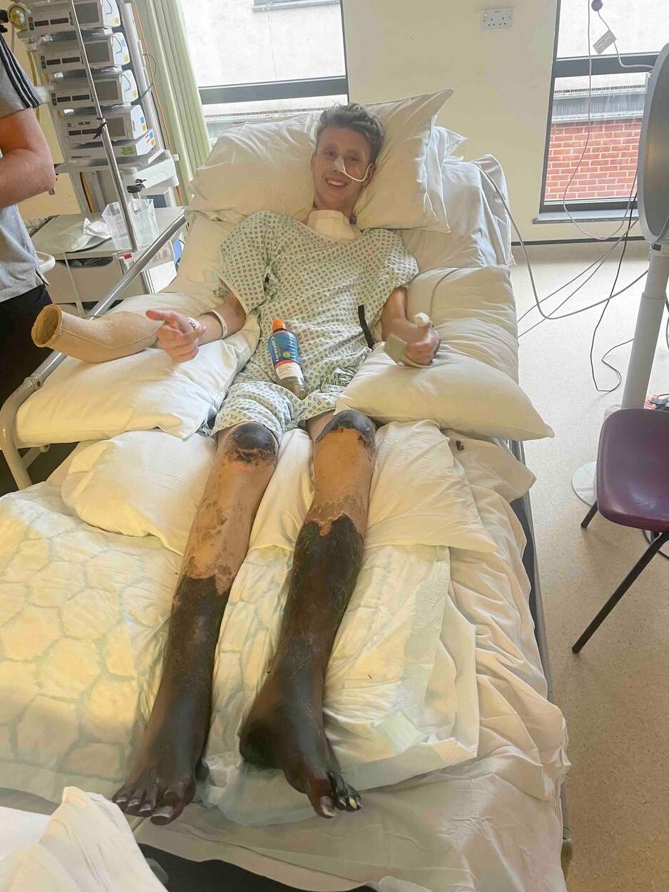 Levijevoj porodici je rečeno da ima samo 30 posto šansi za preživljavanje (Foto: Twitter)