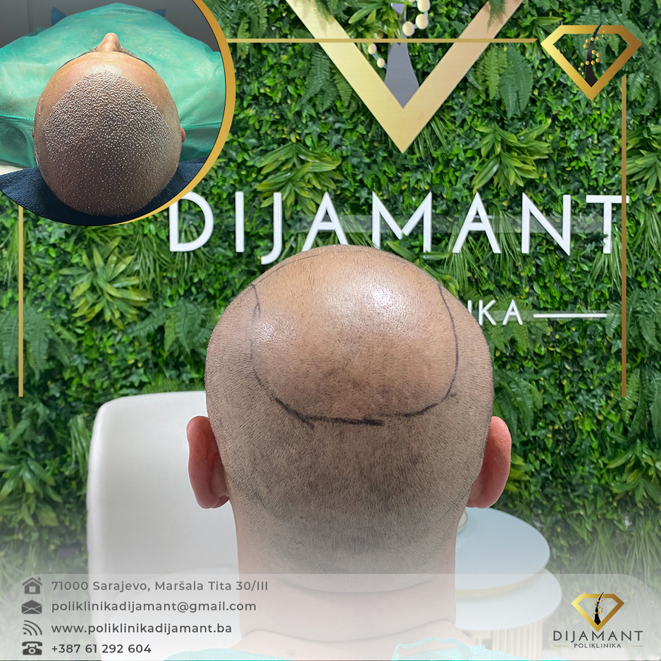 Poliklinika Dijamant
