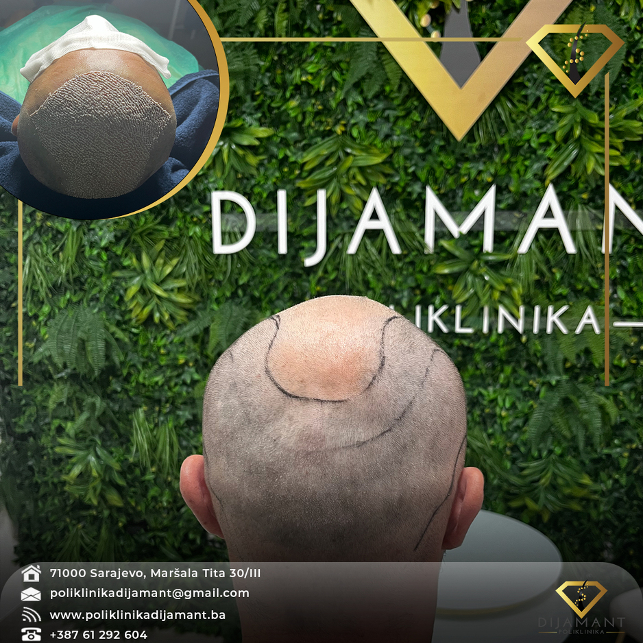 Poliklinika Dijamant