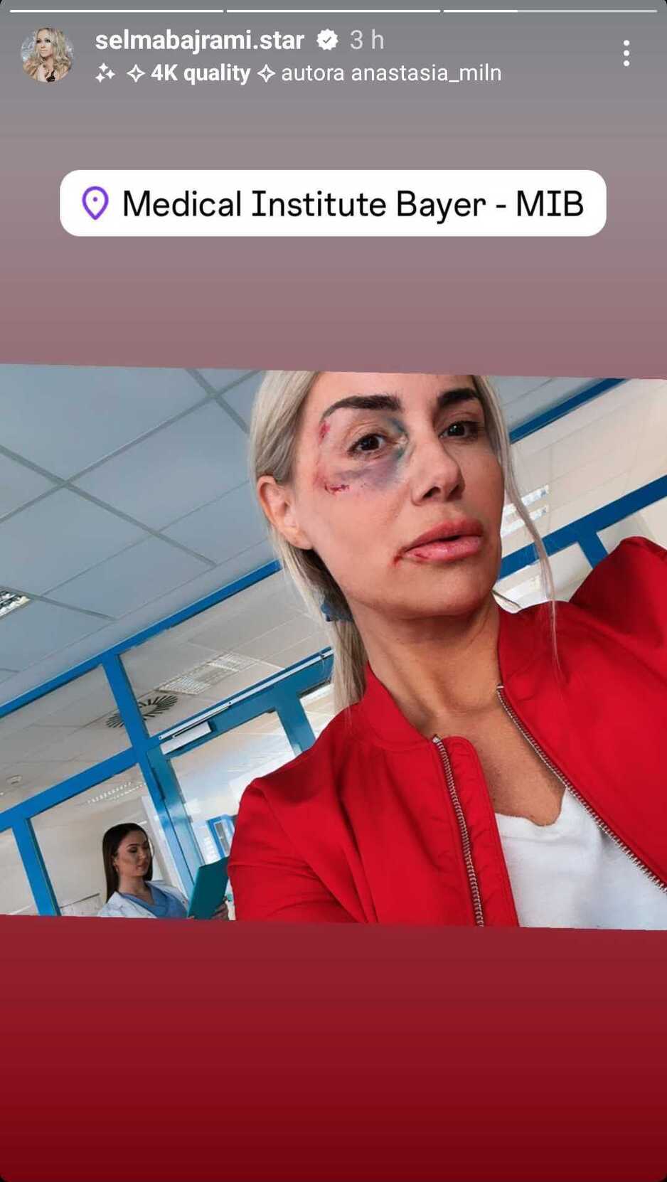 Selma Bajrami (Screenshot/Story)