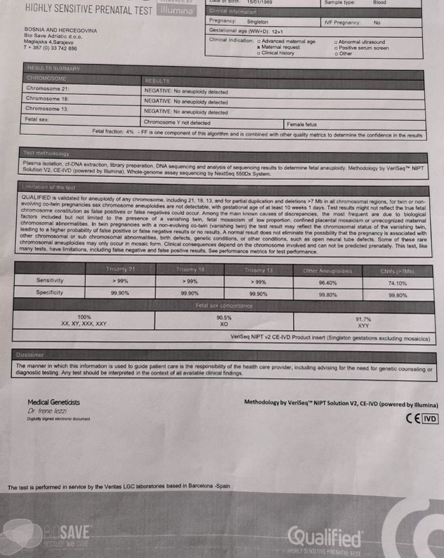 Test rađen u Bio Save-u na tri trisomije – 21 (Down sindrom), 18 (Edwards) i trisomiju 13. Sva tri su bila negativna.