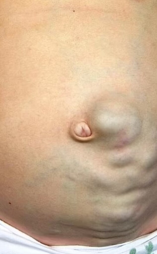Meduzina glava (Foto: Research Gate)