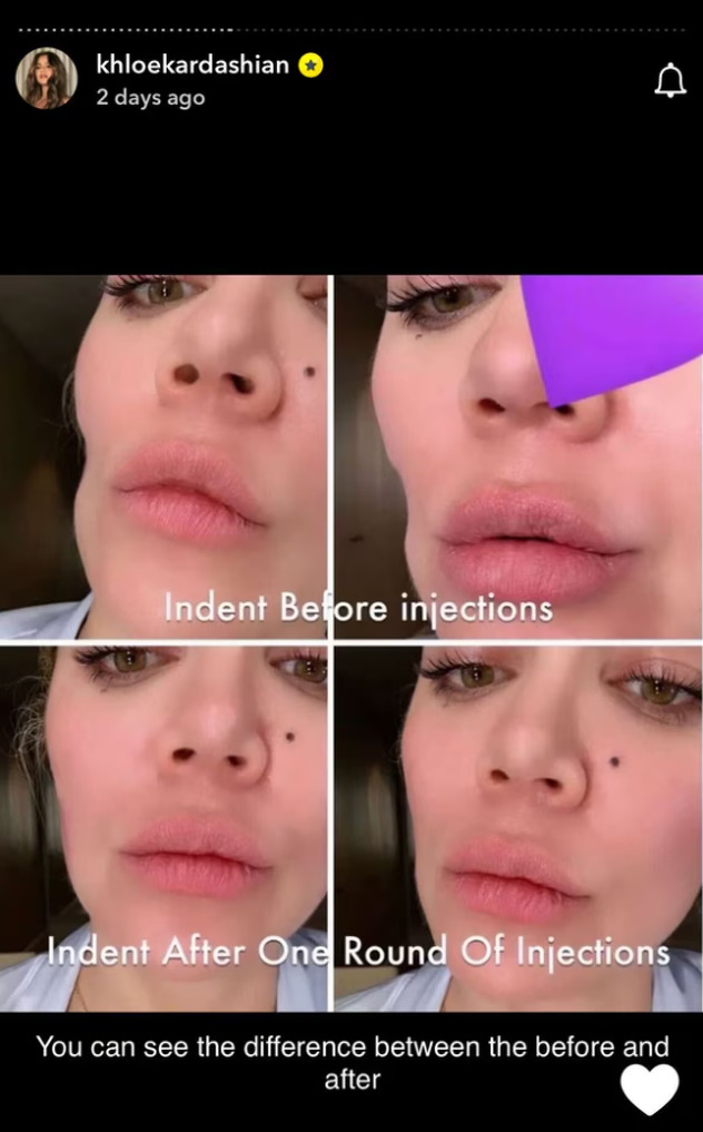 Khloe Kardashian (Foto: Instagram/Screenshot)