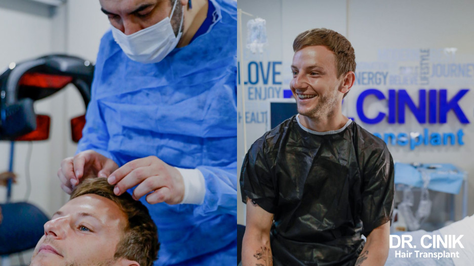 Rakitić presadio kosu (Foto: emrahcinik.com)