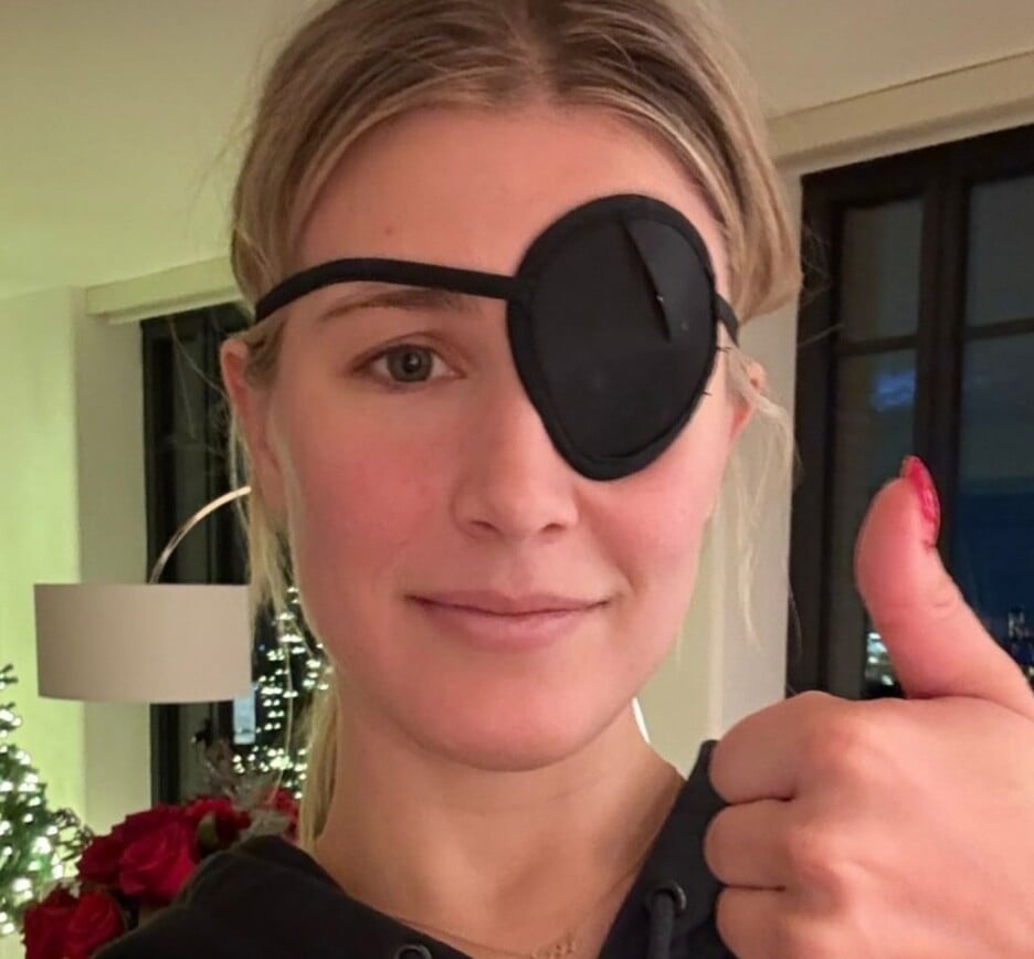 Bouchard s povezom preko oka (Foto: Instagram)