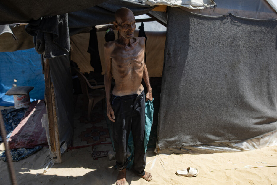 Salim Asfour stoji pored šatora u Khan Younisu, na jugu Pojasa Gaze, Salim, pati od teške pothranjenosti, koja je posljednjih mjeseci. Izgubio je više od 40 kg. (Foto: EPA-EFE)