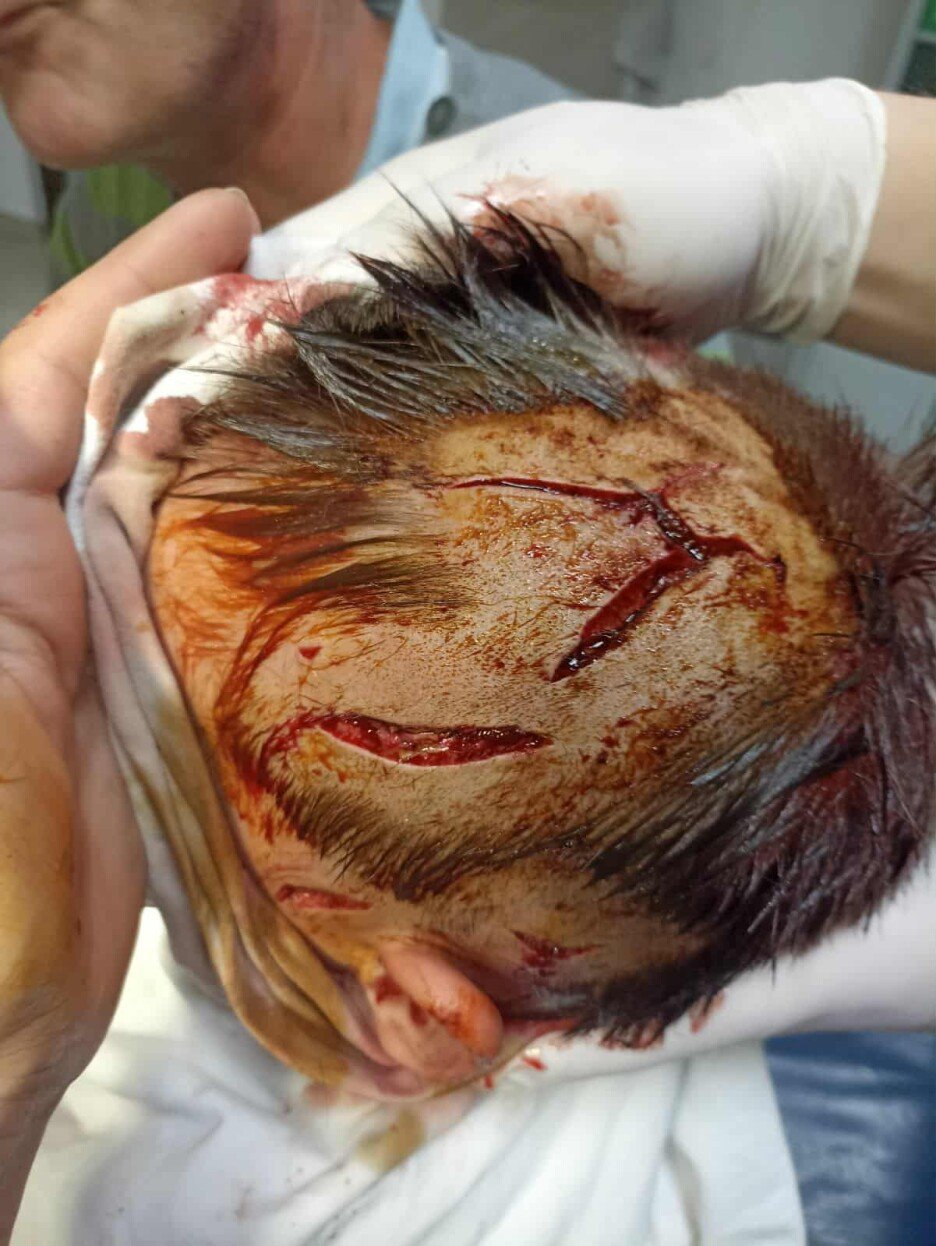 Fotografiju objavljujemo uz odobrenje roditelja (Foto: Klix.ba)