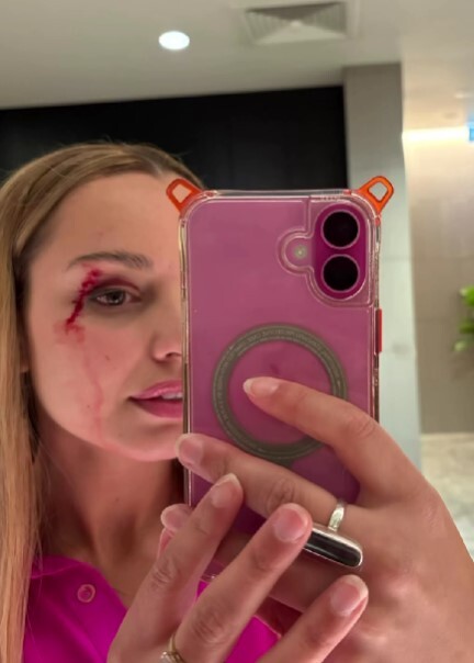 Novinarka je navela da se osjeća dobro (Screenshot: Instagram/jessicatyson08)