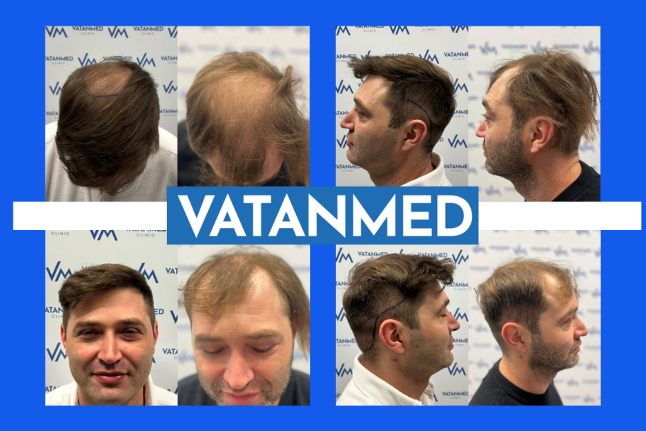 VatanMed