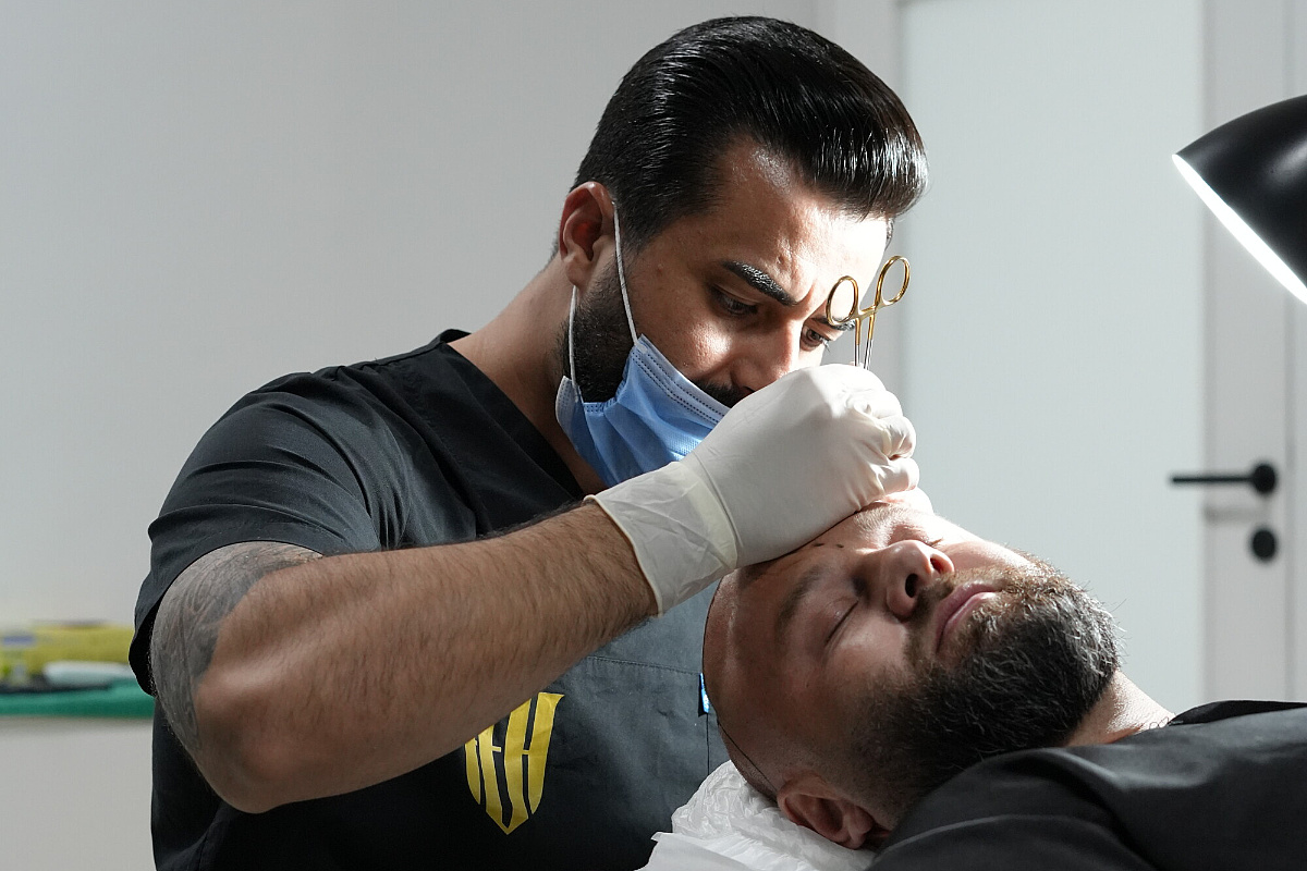 Hasan Hüseyin Kızılkaya: Deset godina iskustva i više od 10.000 pacijenata u oblasti transplantacije kose