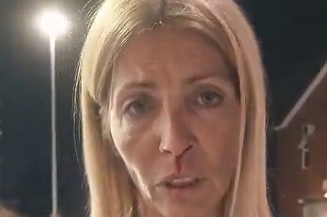 Političarka objavila da je gradonačelnik Beograda napao i slomio joj nos, policija ga je odvela
