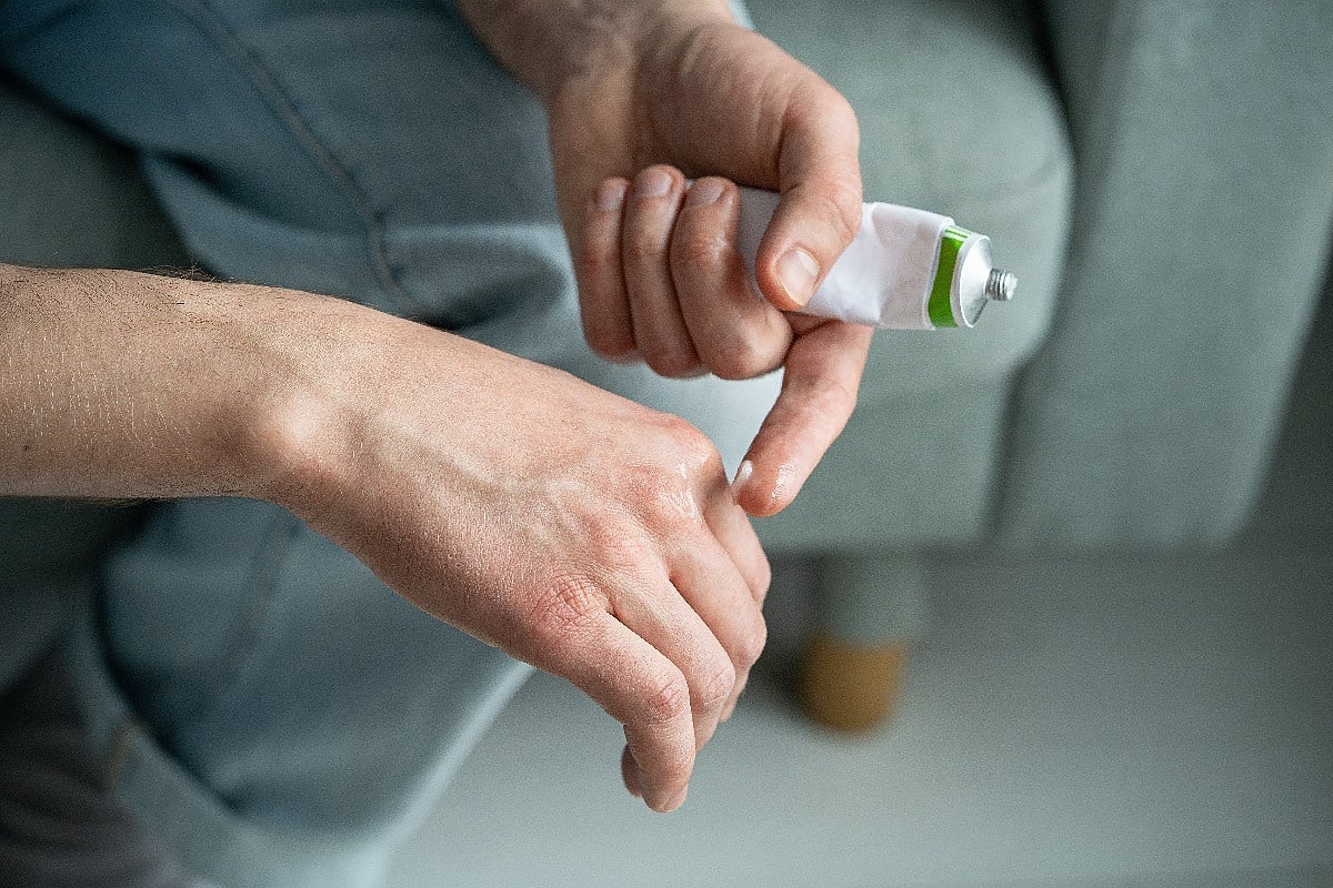 Krenulo grijanje, koža puca: Dermatolozi savjetuju kraće tuširanje i kremu odmah nakon kupanja